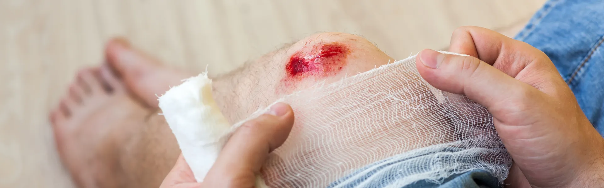 Laceration vs. Skin Tear vs. Abrasion: Know the difference